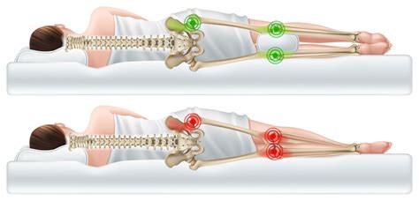 Shockwave therapy for Greater trochanteric pain syndrome — .